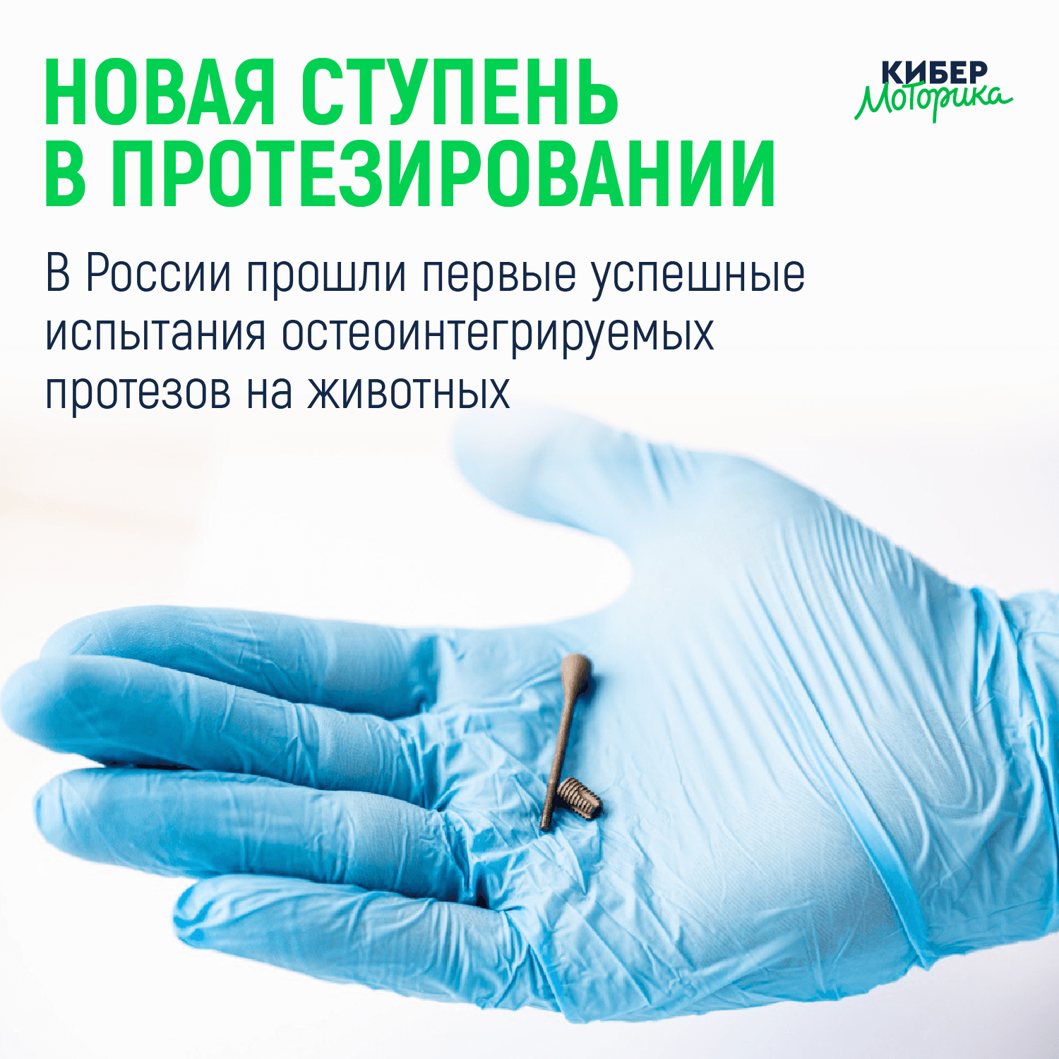 🦿Новая ступень в протезировании: в России прошли первые успешные испытания остеоинтегрируемых проте